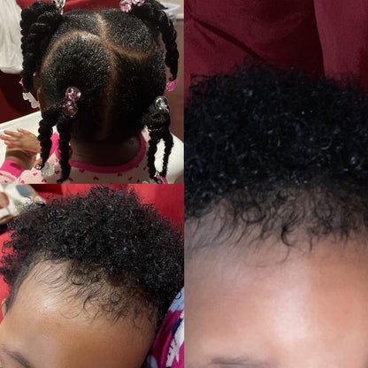 Hair growth results from using Honey Butter.